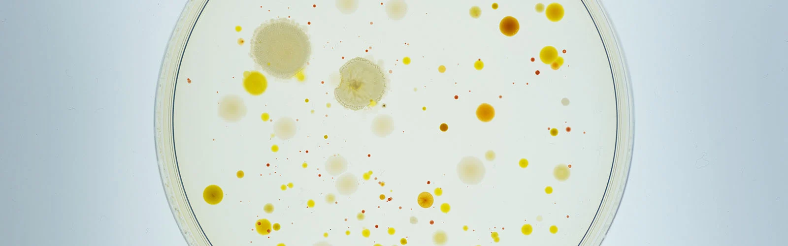 Análisis microbiológico en laboratorio de alimentos