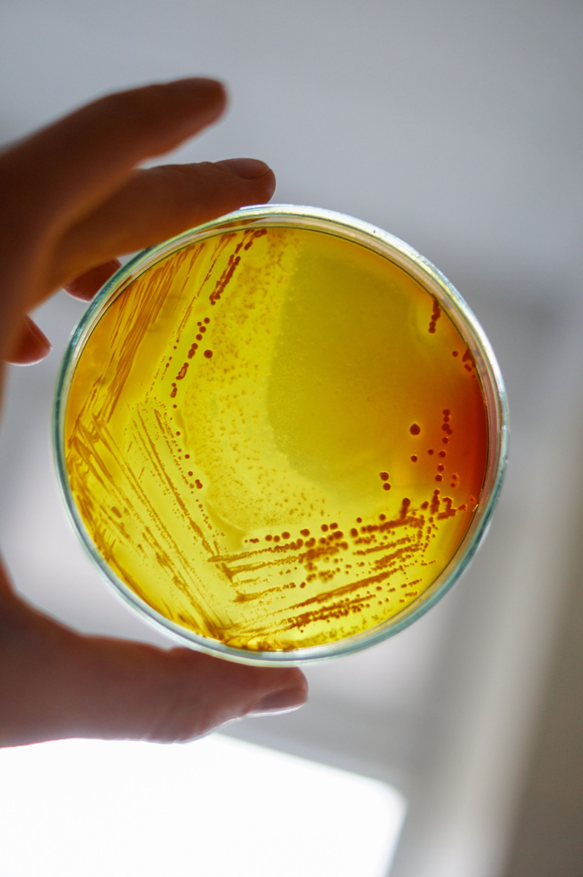 Técnico de laboratorio trabajando con placas microbiológicas