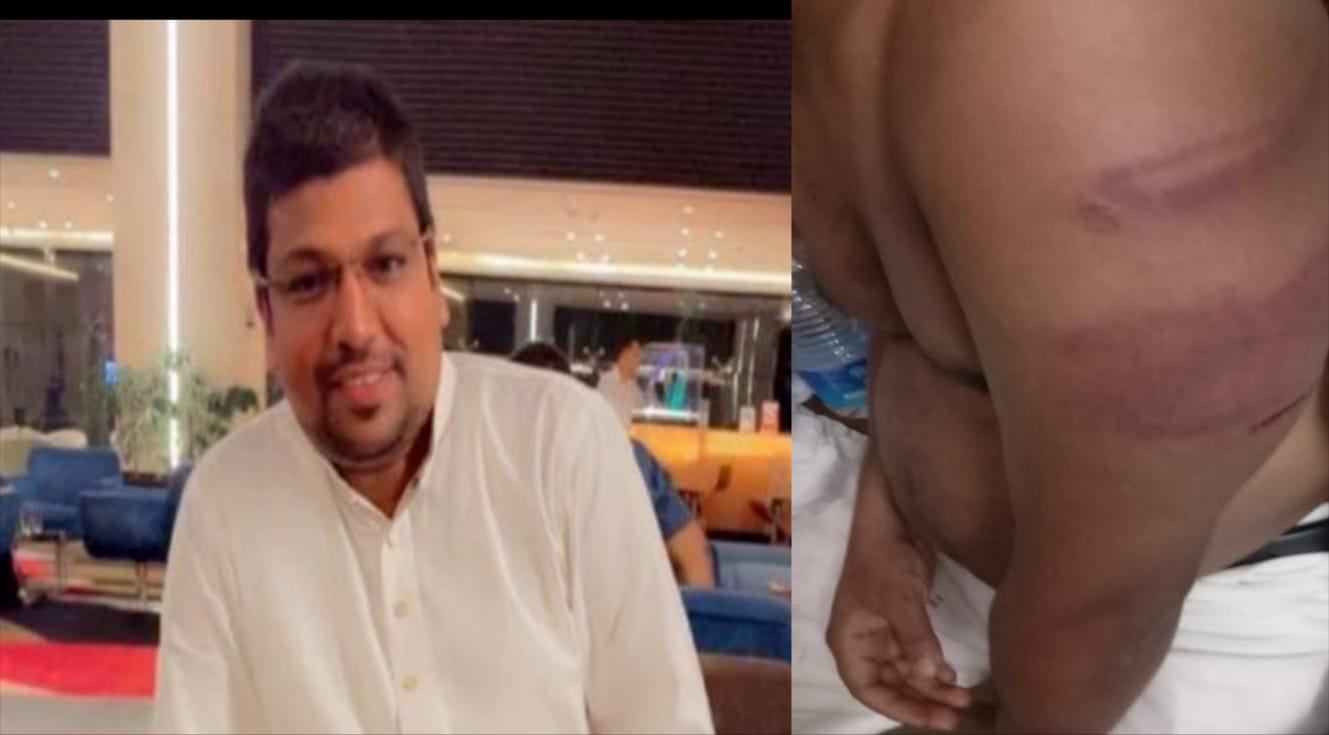 চট্টগ্রামে সাংবাদিক মুন্নার উপর সন্ত্রাসী হামলার নিন্দা